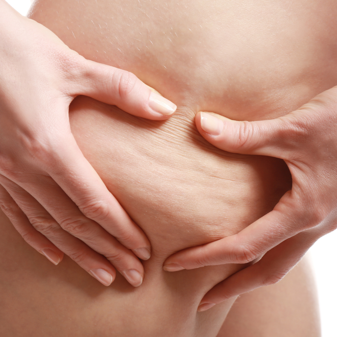 Crema corpo rassoda | Crema corpo rassodante con estratto di mirtillo nero e ananas. - Ideale per gambe, glutei, addome e braccia. Svolge un'importante azione contro l'effetto buccia d'arancia. - Flacone Airless - Formato 150 ml